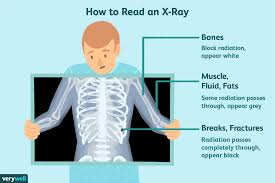 Your enquiry will be forwarded to up to 3 private healthcare providers. X Rays Uses Procedure Results