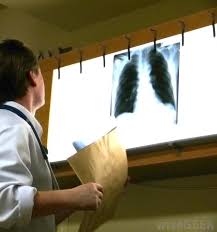 Symptoms are persistent cough, fever, sweats, and weight loss. What Is The Connection Between Cancer And Pneumonia