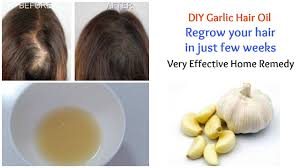 There are many reasons why people may lose their hair. Incredible Benefits Of Garlic For Hair Femina In