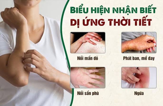 Dị ứng thời tiết: Nỗi ám ảnh của nhiều người là bệnh gì? – Bệnh Viện An Việt