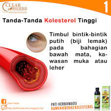 Fungsinya membantu pembentukan selaput sel dan hormon adrenal. Pati Herbamadu Tanda Tanda Kolesterol Tinggi