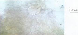 Image result for Fadogia cienkowskii