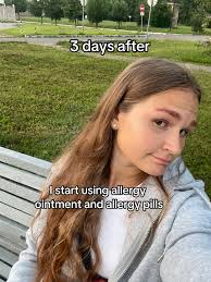 Eyebrow Tint Allergy Remedy