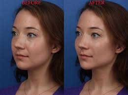 Visual Plastic Surgery