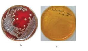 Агар сальмонелла шигелла модифицированный modified salmonella shigella agar. A Escherichia Coli On Sheep Blood Agar B Salmonella Typhi On Download Scientific Diagram