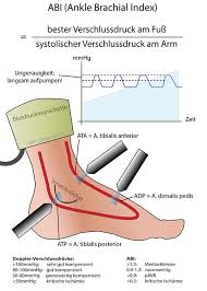 Periphere Verschlusskrankheit Wpgefaessmanual2016
