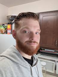 The last 2 photos are from about 2 years ago. 29 years old, near 150# and  an alcoholic. I was much fluffier then as I was drinking everyday. I'm  going