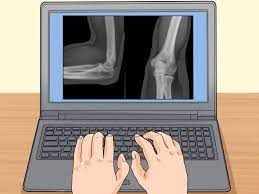 How to take x ray photos. How To Prepare For An X Ray 14 Steps With Pictures Wikihow