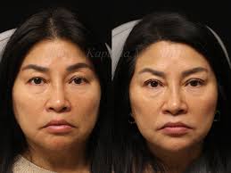 Re-introducing my rock star physician assistant