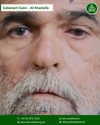 Last year's free cataract surgery changed her life. Now she's back for the  second one ! still free of cost. www.sarwarfoundation.org.pk