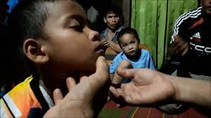 Check spelling or type a new query. Benjolan Di Bawah Dagu Seorang Anak Sembuh Oleh Nama Yesus Youtube