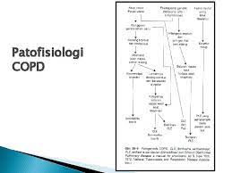 Check spelling or type a new query. Patofisiologi Penyakit Paru Penyakit Pernafasan Obstruktif Penyakit Paru