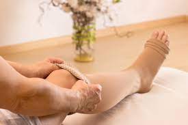 Varicose Vein Sclerotherapy Treatment What To Expect La Jolla Vein Care Accredited Vein Center