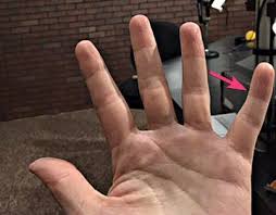 When it bears the extra weight of your phone for. What Is A Smartphone Pinky All That You Should Know To Prevent It