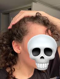 Detta är progress från  sågpalmetto/Nutrafol/hårbottenmassage/meditation/proteinrik kost. Även om  jag fick resultat, använder jag nu finasterid, microneedling och fasar ut  sågpalmetto/Nutrafol. : r/FemaleHairLoss