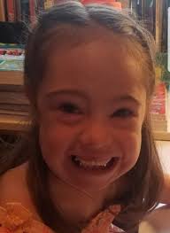 Do you know that only 20% of eggs with an extra 21st chromosome survives  fertilization? And of that 20% only 20% actually survive the first cell  division following fertilization? What are the