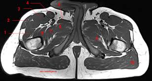 Corpus cavernosum of the penis. Mri Of The Thigh Detailed Anatomy Superior Part W Radiology