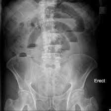 Pin On X Ray