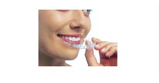 A seconda del tipo di trattamento e del miglioramento, le mascherine possono essere usate per un lasso di tempo medio fra i 18 ed i 24 mesi.in alcuni casi invece la durata del trattamento è molto più breve, addirittura anche solo sei mesi. Mascherine Per I Denti Storti Come Funzionano Sbiancamento Denti