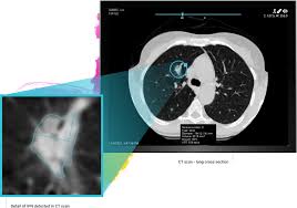 Image result for Incidental Imaging Finding
