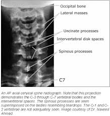 Radiographic Positioning Techniques For The Cervical Spine