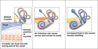 When feeling dizzy, a person. Inner Ear Problems Causes Of Dizziness Vertigo Articles Mount Nittany Health System