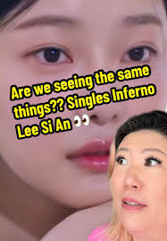 Lee Sian Before After Chin