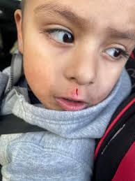 Autism Parents Support Group