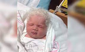 Now on instagram maya is followed by more than 23.2 thousand people, and we invite you to take a look at the beautiful feature of this baby. The Truth Behind This White Haired Baby Kiwireport
