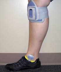 Orthotic Considerations For Foot Drop After Stroke Lower Extremity Review Magazine Carbon Fiber Afo Stores Energy Ankle Foot Orthosis Orthotics Foot Drop