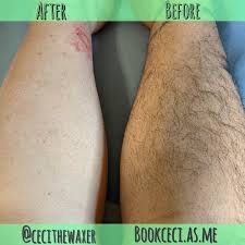 Ingrown hairs are similar to pimples in the sense that the hair follicle where the skin is trapped is acting similar to a clogged pore. Leg Waxing Body Waxing Facial Waxing Waxing