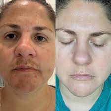 Deniz Akyol (@skinhealthbydeniz) · Jacksonville, FL · Instagram photos and  videos