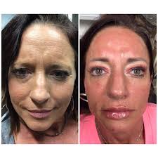 Elite Smiles & Medaesthetics