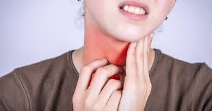 بينما التهاب اللوزتين هو أكثر انتشارا بين الأطفال في سن المدرسة ، فإنه يمكن أن يحدث أيضا في عند استخدام هذا العلاج لالتهاب اللوزتين ،وسوف تساعد على طرد الجراثيم الموجودة على سطح شاي البابونج لتخفيف التهاب اللوزتين. Ø£Ø¹Ø±Ø§Ø¶ Ø§Ù„ØªÙ‡Ø§Ø¨ Ø§Ù„Ù„ÙˆØ² Ø¹Ù†Ø¯ Ø§Ù„Ø£Ø·ÙØ§Ù„ Ø§Ù„ÙŠÙˆÙ… Ø§Ù„Ø³Ø§Ø¨Ø¹