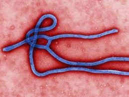 The transmission from a bush animal to one human eventually caused 28 652 cases and 11 325 deaths. Ebola Infektion Symptome Und Geschichte Darum Ist Das Virus So Gefahrlich Gesundheit