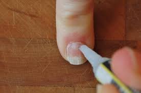 Oct 17, 2018 · immerse your skin in warm soapy water. Is Superglue Bad For Your Nails Hollyberry Cosmetics