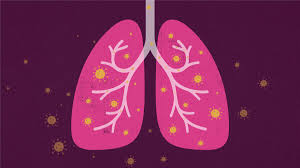 2,621,293 likes · 251,283 talking about this. Coronavirus Long Term Effects Some Covid 19 Survivors Face Lung Scarring Heart Damage And Anxiety Vox