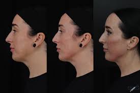 Sara Painter Katzenbach (@paintswithneedles) · Instagram 照片和视频