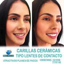 🔊🔊INCREIBLE❗ ✓CARILLAS DENTALES DE ALTA ESTÉTICA A CÓMODOS PLANES DE  PAGO👌 💎 Una sonrisa armoniosa, juvenil , blanca , saludable, permite  resaltar la belleza de tu rostro en todo momento.😁 💎 Anímate;