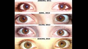 Image Result For Raw Diet Eyes Eye Color Change Change Your Eye Color Eye Color