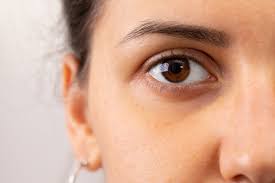 Découvrez notre sélection de produit pour le traitement des cernes et les poches des yeux. Cernes Poches Contour Des Yeux Archives Oleassence En Luberon