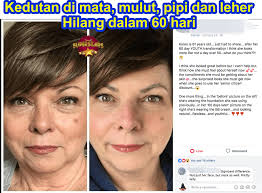 Maybe you would like to learn more about one of these? 9 Set Youth Skincare Shaklee Untuk Jeragat Jerawat Kulit Berminyak Kering Kulit Berminyak Produk Perawatan Kulit Jerawat