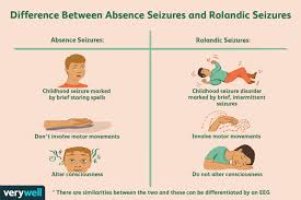 Possible causes, signs and symptoms, standard treatment options and means of care and support. Rolandic Epilepsy Symptoms Causes Diagnosis And Treatment