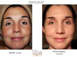 Reverse The Damage Rodan And Fields Rodan And Fields Reverse My Rodan And Fields