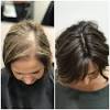 Thinning Edges