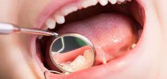 How To Handle Your Child S Loose Baby Tooth