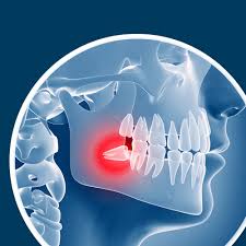 The procedure goes something like this:. Wisdom Teeth Removal Logan Ut Garland Ut Gregory E Anderson Pc