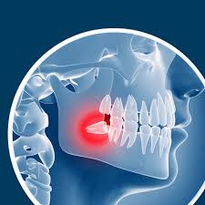 Check spelling or type a new query. Wisdom Teeth Removal Logan Ut Garland Ut Gregory E Anderson Pc
