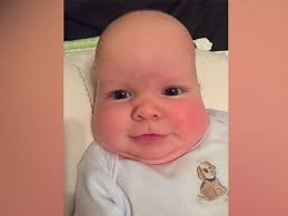 Infant S Unusual Head Shape Reveals Dangerous Condition Baby Head Shape New Baby Products Head Shapes