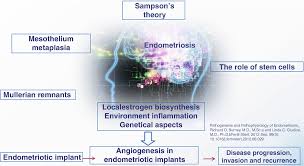 Find out what each endometriosis stage really means, and learn more about endometriosis. Endometriosis And Adenomyosis In Adolescents And Fertile And Menopausal Women Springerlink